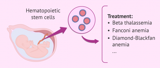 Savior sibling stem cell transplant