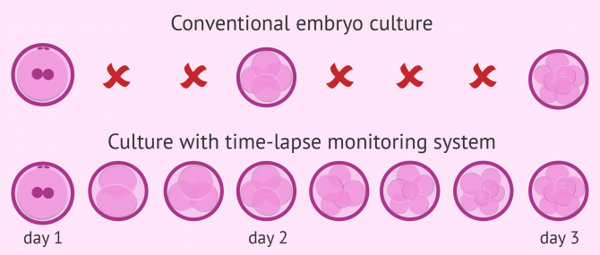 Conventional vs. time-lapse embryo culture