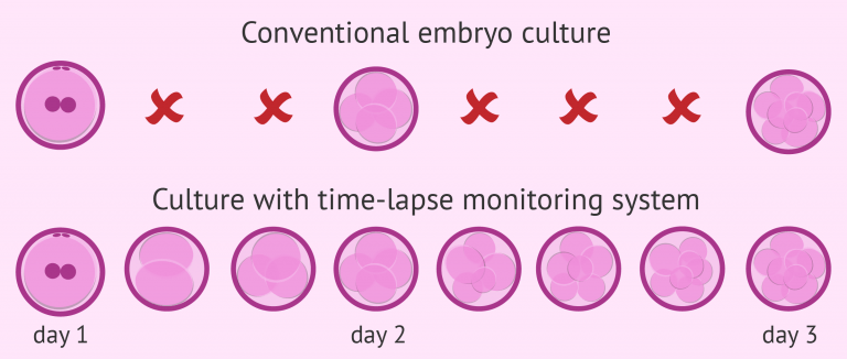 What Is Time Lapse Technology In Ivf Definition And Benefits 6288