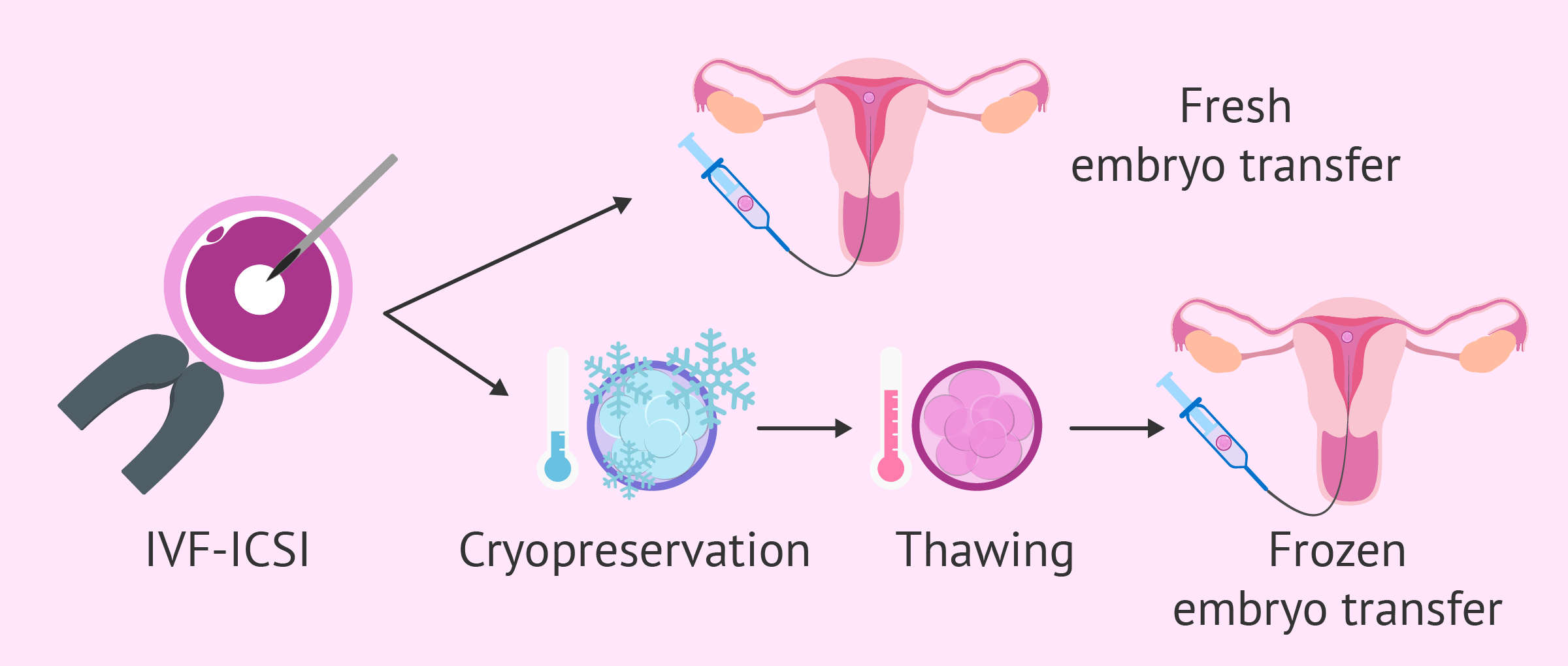 Fresh Vs Frozen Embryo Transfer