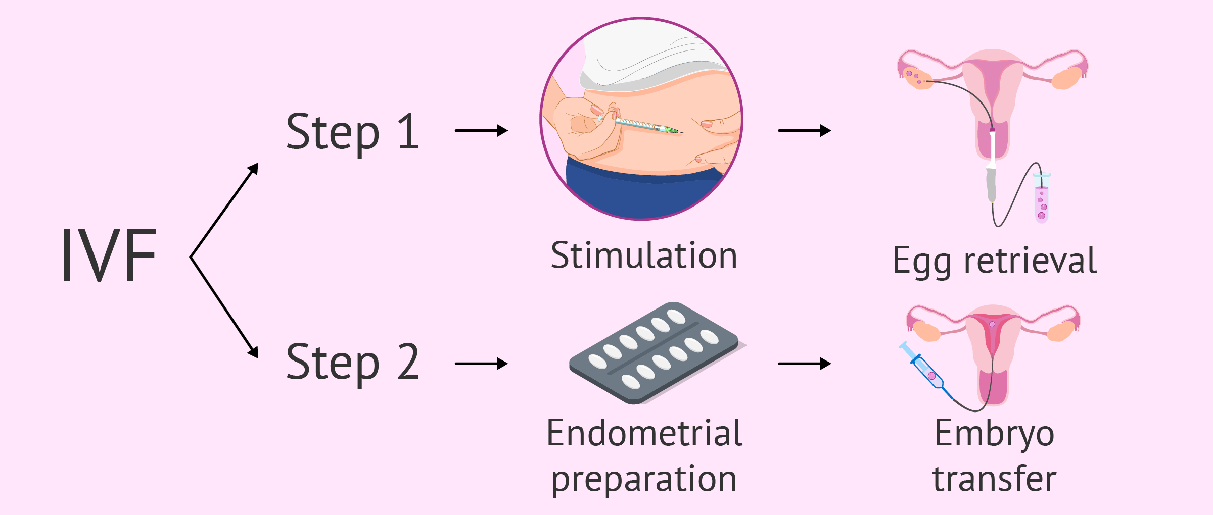 IVF Procedure Steps