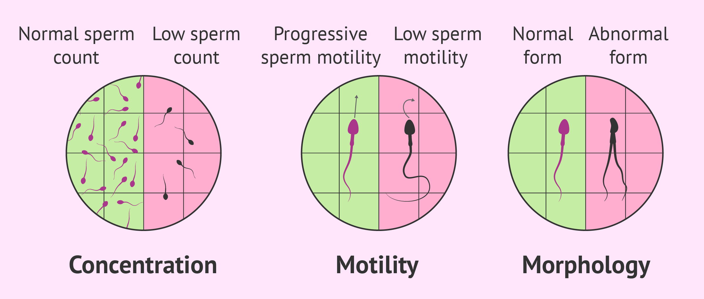 Sperm Abnormalities