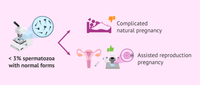 Imagen: children-with-three-percent-normal-sperm-faq