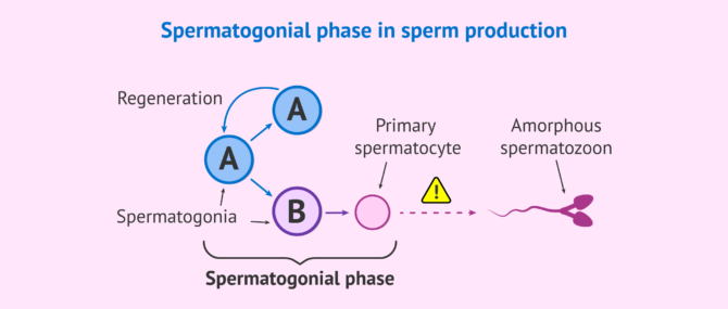 Imagen: Alteration in sperm formation