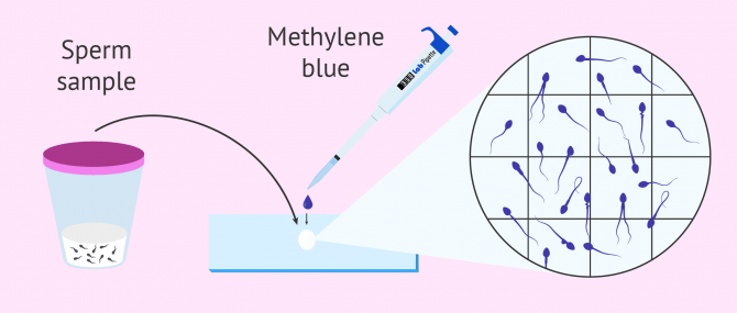 Staining technique to evaluate human sperm morphology