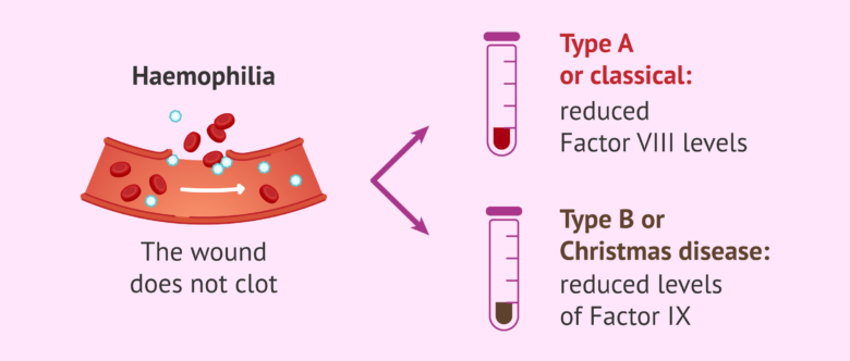 Two types of hemophilia