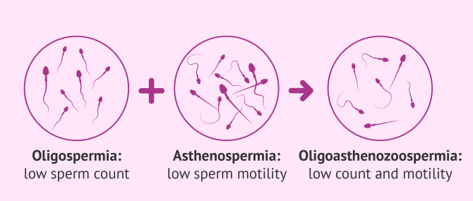 Oligoasthenozoopermia definition