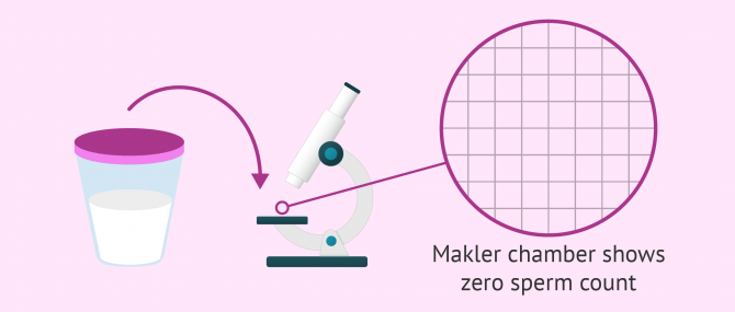 Sperm count analysis