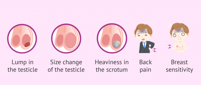 Imagen: Which Symptoms of testicular cancer?