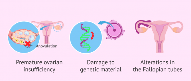 Imagen: Fertility problems after treatment