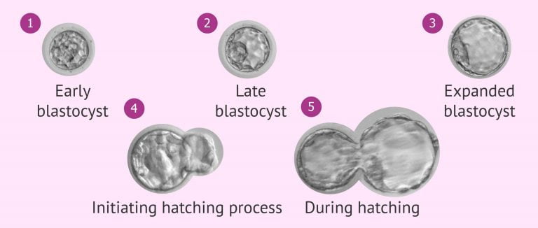 blastocyst-expansion-rates