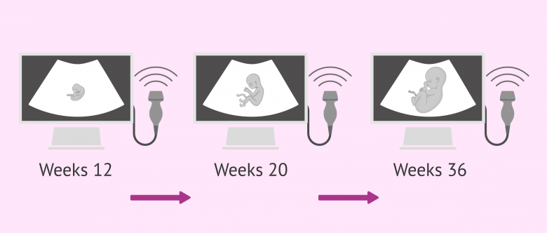 Fetal Ultrasounds During Pregnancy