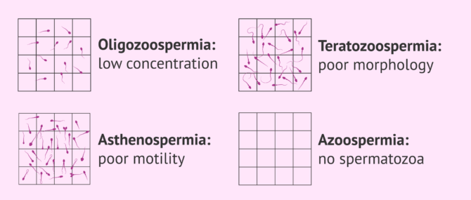 Imagen: Alterations in semen quality