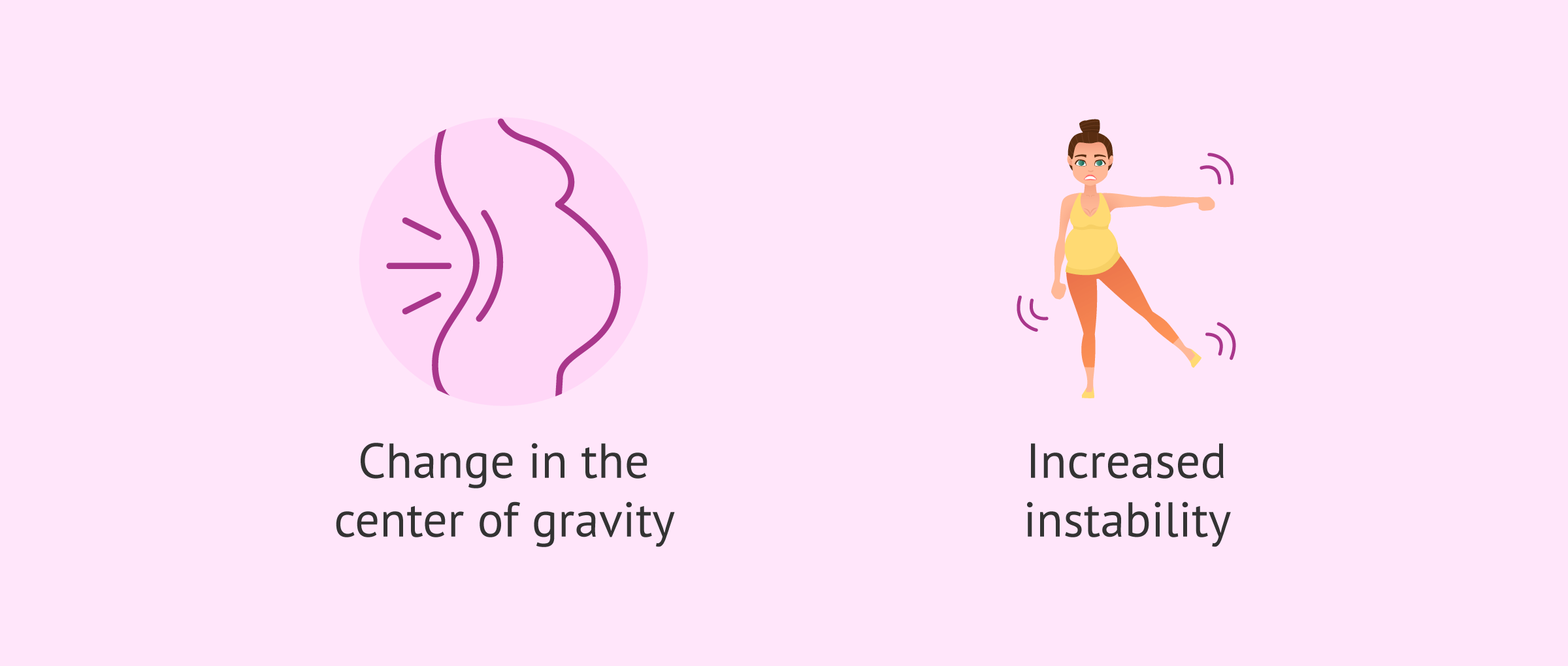 Imagen: Musculoskeletal changes during pregnancy