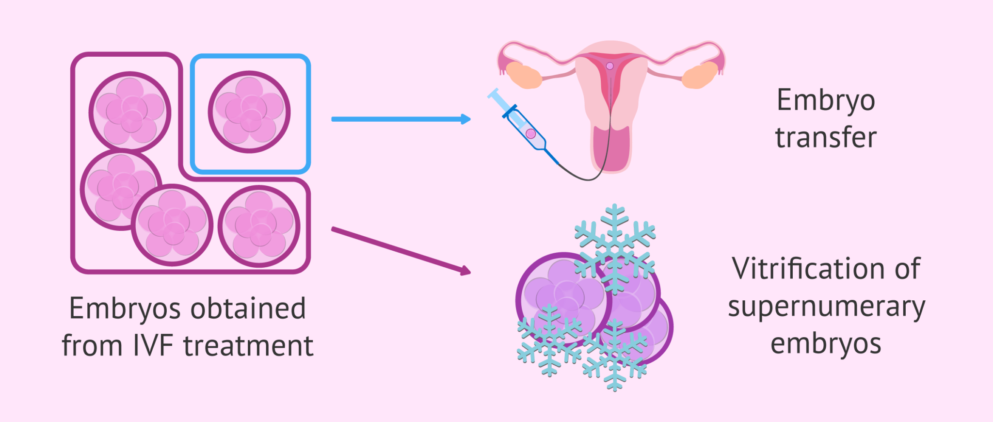 Vitrification of supernumerary embryos