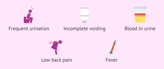 Imagen: What are the symptoms of urine infections?