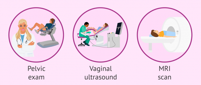 Imagen: How adenomyosis is diagnosed