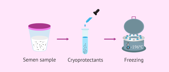 Imagen: Sperm freezing process