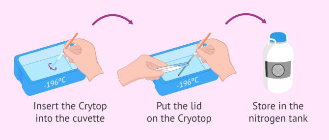 Imagen: Introduction of Cryotop in liquid nitrogen