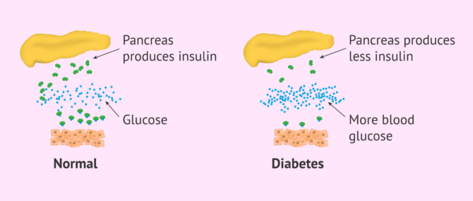 Imagen: Why does diabetes occur?