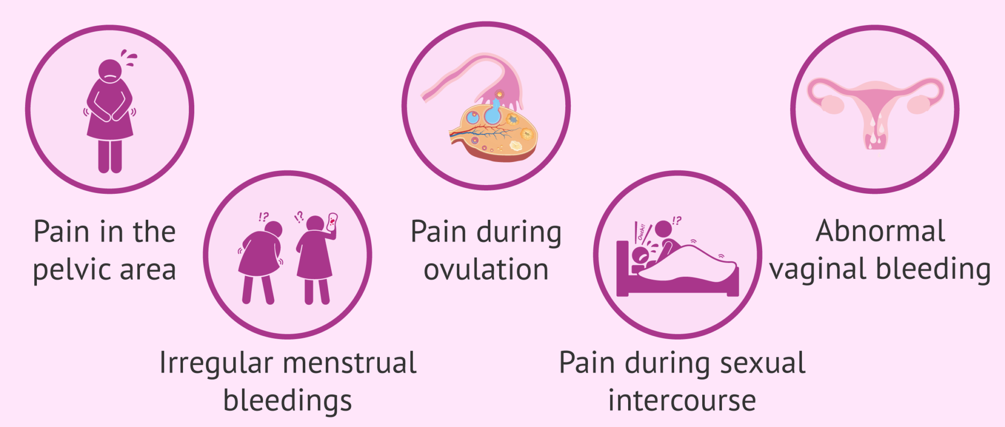 What Is Salpingitis? Causes, Symptoms & Treatment