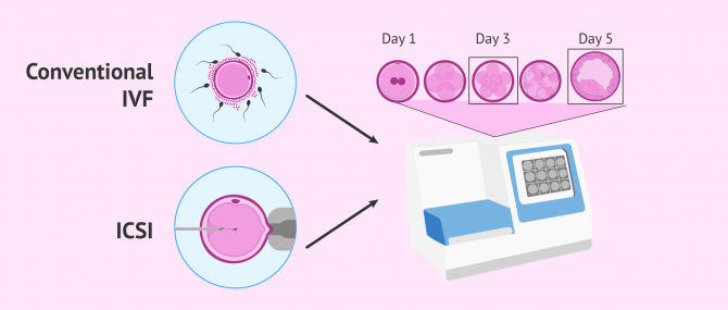 Imagen: What is embryo culture?