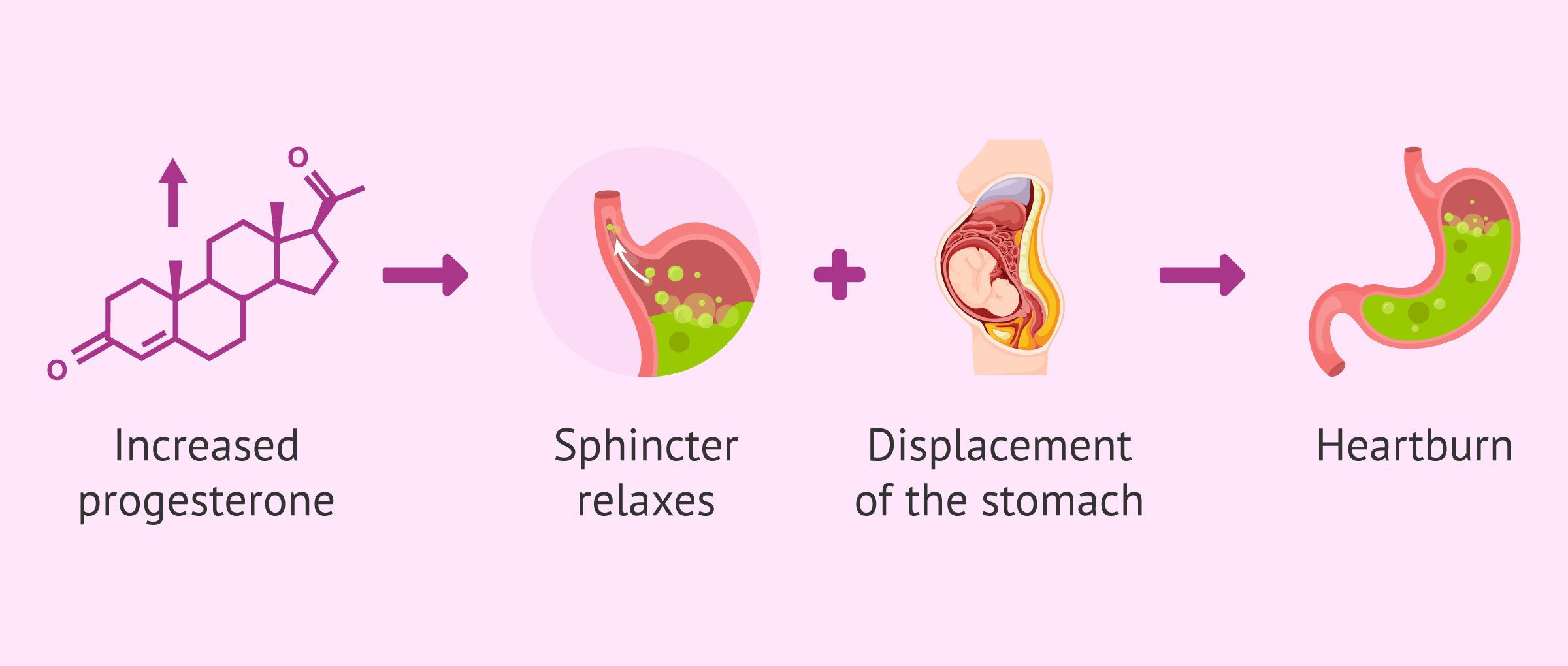 What Causes Heartburn And Other Digestive Discomfort In Pregnancy 