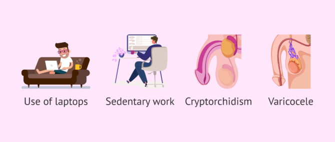 Imagen: What causes hyperthermia of the scrotum?