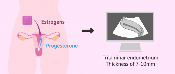 Imagen: endometrial preparation