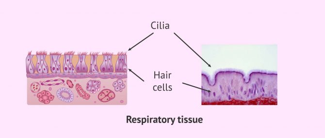 Imagen: Ciliary Respiratory Epithelium and Kartagener's Syndrome