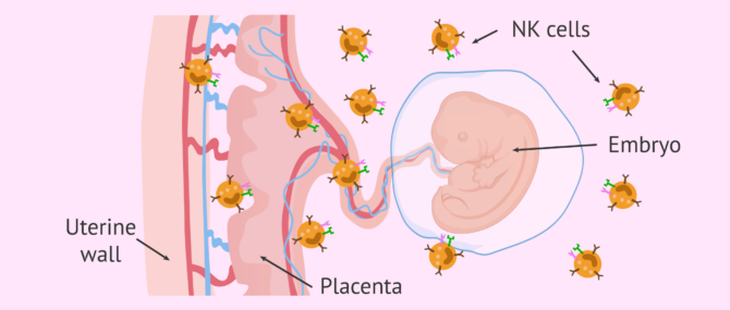 Imagen: Lymphocytes attacking the embryo and causing miscarriage