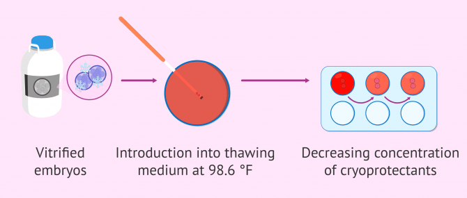 Imagen: Embryo devitrification process