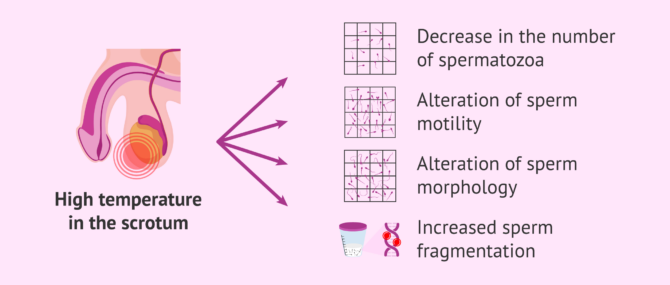 Imagen: Consequences of scrotal hyperthermia