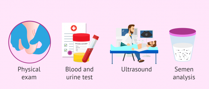 Imagen: Diagnostic tests for epididymitis