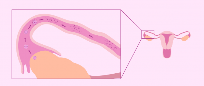 Imagen: Natural fertilization in the fallopian tubes