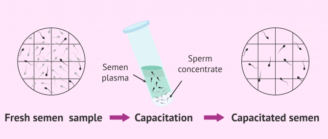 Imagen: Results of the advanced semen analysis