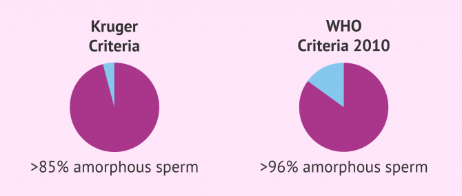 Imagen: Teratozoospermia according to Kruger and WHO criteria