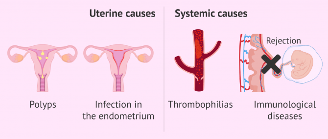 Imagen: Uterine and systemic causes of implantation failure