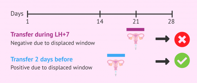 Imagen: Displaced implantation window and embryo transfer