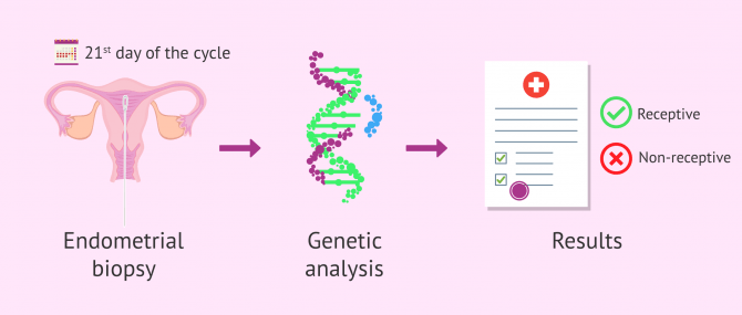 Imagen: How the ERA test works