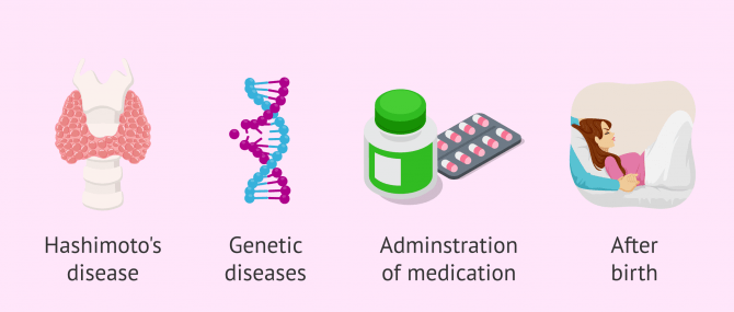 Imagen: Factors that increase the risk for hypothyroidism