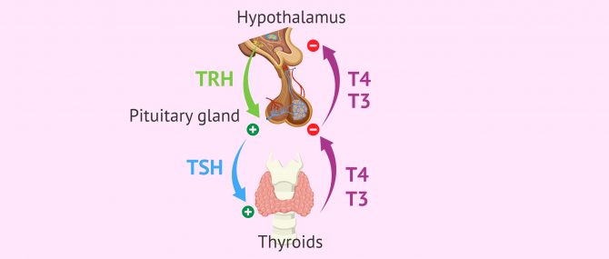 Imagen: Outline of hypothyroidism