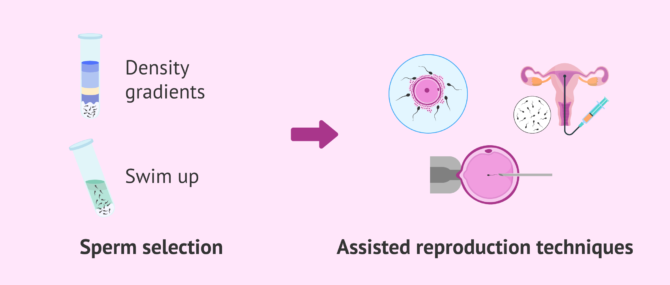 Imagen: Traditional methods of sperm selection