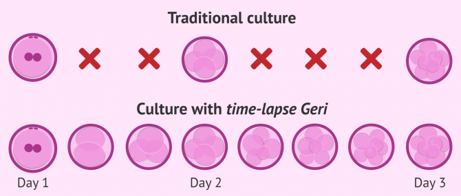 Imagen: Comparison of traditional and Time-Lapse Geri embryo culture