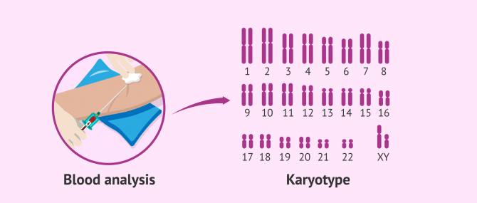 Imagen: Study of the karyotype in men