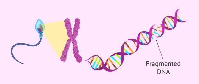 Imagen: Spermatozoa DNA fragmentation