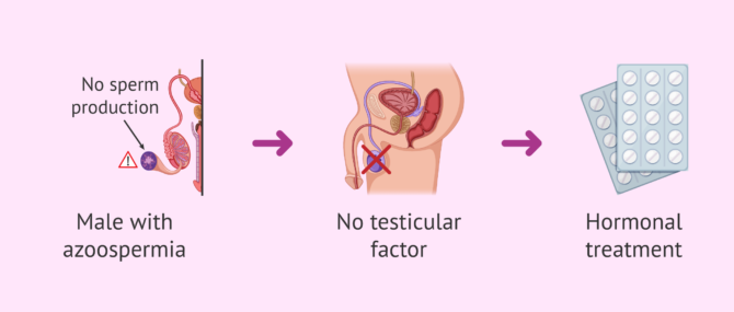 Imagen: Hormonal treatment as a solution for azoospermia