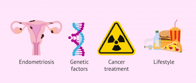 Imagen: Causes of a low ovarian reserve