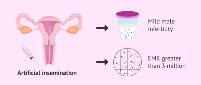 Imagen: AI for male infertility