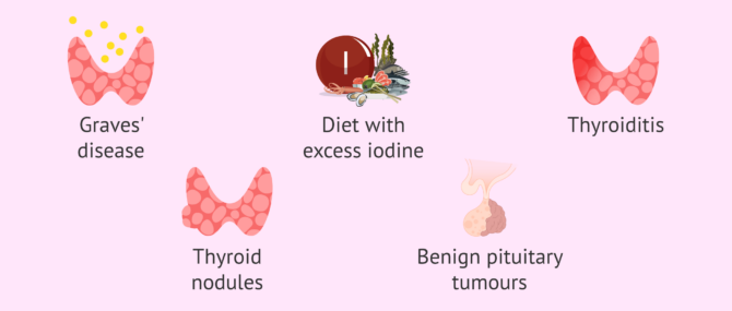 Imagen: Causes of hyperthyroidism